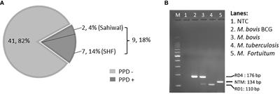 Divergent proinflammatory immune responses associated with the differential susceptibility of cattle breeds to tuberculosis